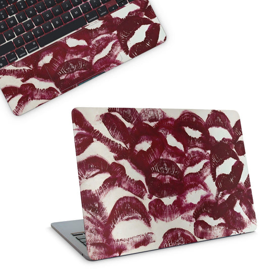 Kisses Macbook Skin - macbook skins